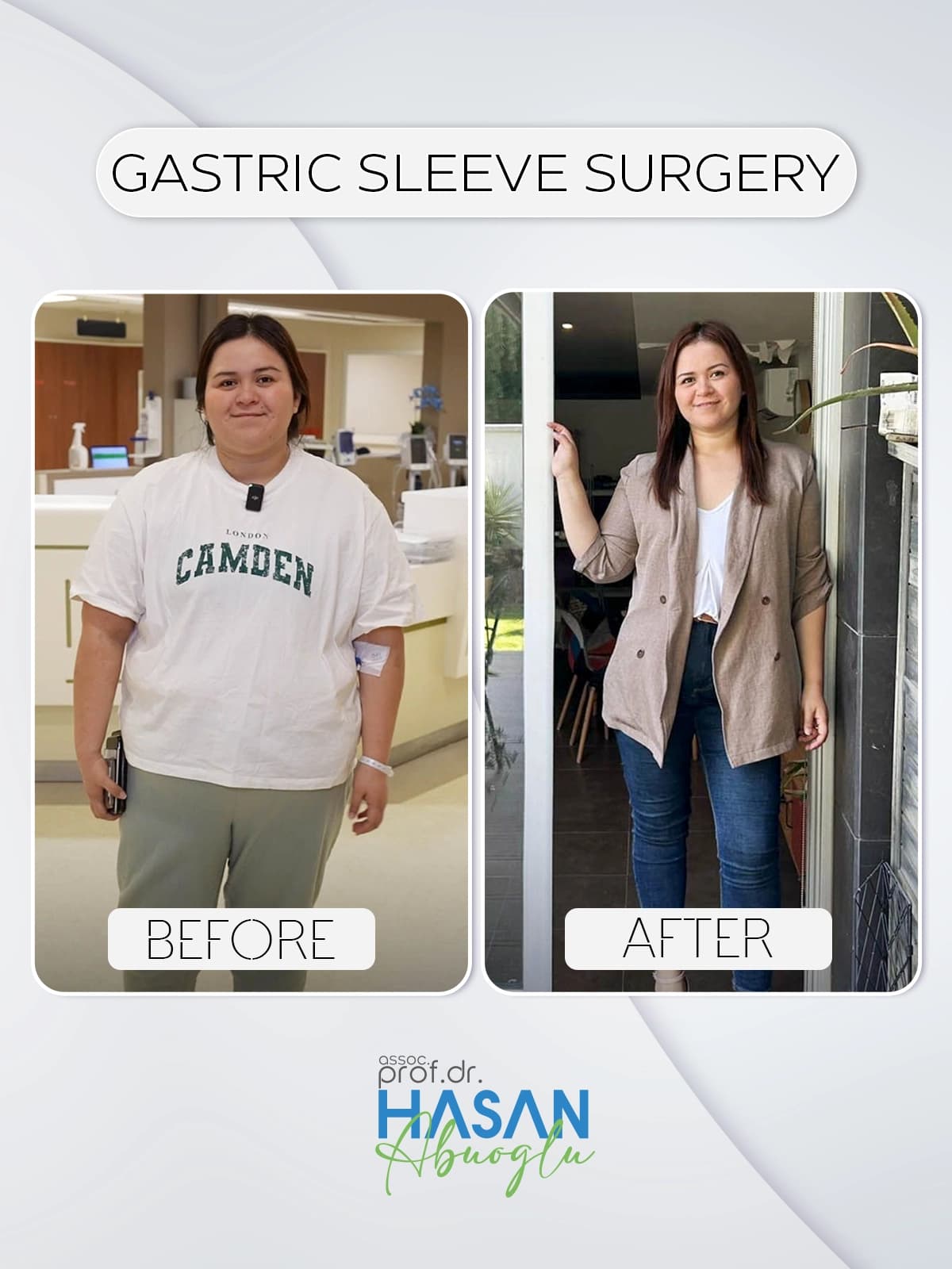 Gastrik bypass öncesi ve sonrası hasta dönüşümü